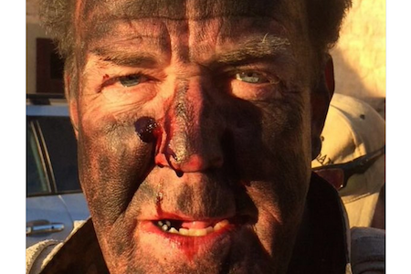 Jeremy Clarkson verletzt